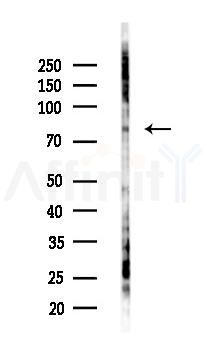 WBP7 Antibody - Western blot analysis of lysates from K562 cells(UV 30min treatment), using WBP7 Antibody at 1/1000 dilution.