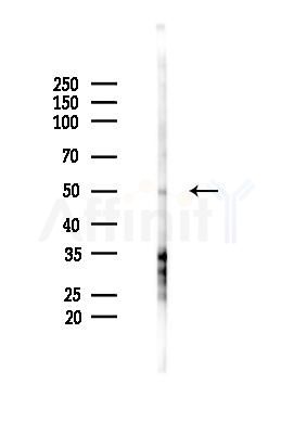 TRIM35 Antibody - Western blot analysis of lysates from HUVEC cells(starvation 24h treatment), using TRIM35 Antibody at 1/1000 dilution.
