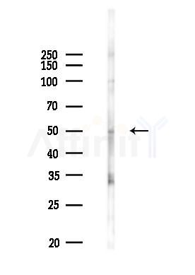 5HT2A Receptor Antibody - Western blot analysis of lysates from PC12 cells(UV 30min treatment), using 5HT2A Receptor Antibody at 1/1000 dilution.