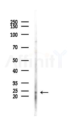 FGF16 Antibody - Western blot analysis of lysates from COLO205 cells(heat-shock 45min treatment), using FGF16 Antibody at 1/1000 dilution.