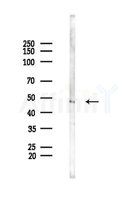 IFI44 Antibody - Western blot analysis of lysates from PC12 cells(UV 30min treatment), using IFI44 Antibody at 1/1000 dilution.