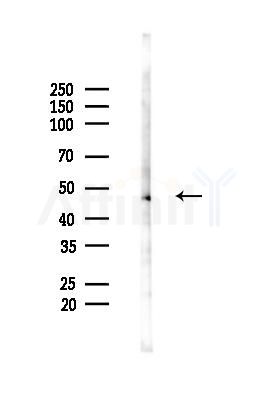 IFI44 Antibody - Western blot analysis of lysates from HUVEC cells(starvation 24h treatment), using IFI44 Antibody at 1/1000 dilution.