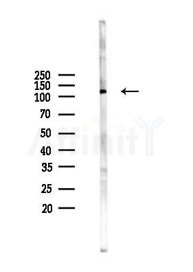 ITGAD Antibody - Western blot analysis of lysates from Rat brain, using ITGAD Antibody at 1/1000 dilution.