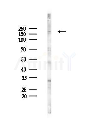 KDM5A Antibody - Western blot analysis of lysates from HUVEC cells(starvation 24h treatment), using KDM5A Antibody at 1/1000 dilution.