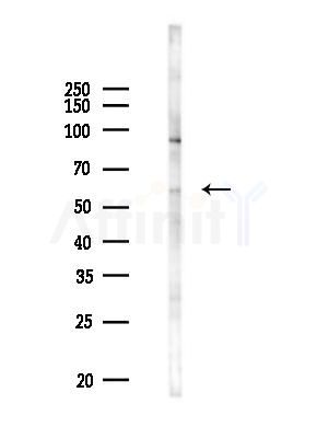KRT3/6A/75/76 Antibody - Western blot analysis of lysates from PC12 cells(UV 30min treatment), using KRT3/6A/75/76 Antibody at 1/1000 dilution.