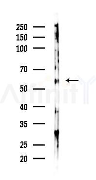KRT83 Antibody - Western blot analysis of lysates from 293 cells(UV 30min treatment), using KRT83 Antibody at 1/1000 dilution.
