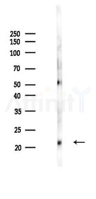MYL6B Antibody - Western blot analysis of lysates from Mouse brain, using MYL6B Antibody at 1/1000 dilution.