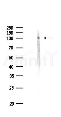 LAMC2 Antibody - Western blot analysis of lysates from HUVEC cells(UV 30min treatment), using LAMC2 Antibody at 1/1000 dilution.