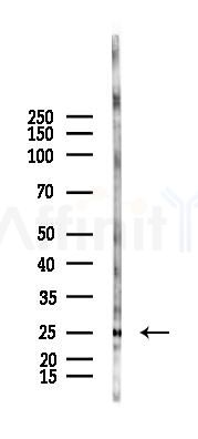 CIDEA Antibody - Western blot analysis of lysates from Rat liver, using CIDEA Antibody at 1/1000 dilution.