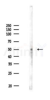 EDAR Antibody - Western blot analysis of lysates from HUVEC cells(UV 30min treatment), using EDAR Antibody at 1/1000 dilution.