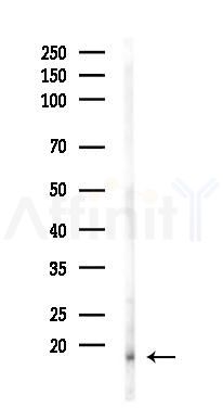 MRPL55 Antibody - Western blot analysis of lysates from 293 cells(UV 30min treatment), using MRPL55 Antibody at 1/1000 dilution.