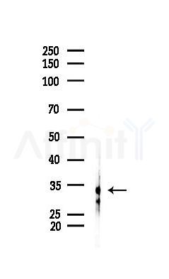 ABHD10 Antibody - Western blot analysis of lysates from A2780 cells(starvation 24h treatment), using ABHD10 Antibody at 1/1000 dilution.
