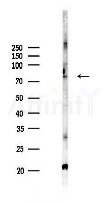 ACAD11 Antibody - Western blot analysis of lysates from HUVEC cells(UV 30min treatment), using ACAD11 Antibody at 1/1000 dilution.