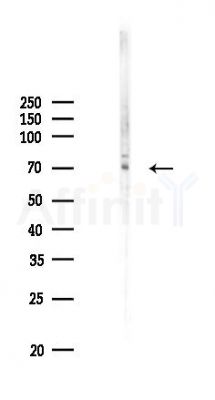 ADAM23 Antibody - Western blot analysis of lysates from HUVEC cells(UV 30min treatment), using ADAM23 Antibody at 1/1000 dilution.