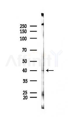 ALDH3B2 Antibody - Western blot analysis of lysates from A2780 cells(starvation 24h treatment), using ALDH3B2 Antibody at 1/1000 dilution.