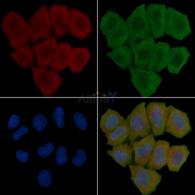 ACCN2 Antibody - DF9198 staining Hela cells(45min of heat-shock treatment) by IF/ICC.