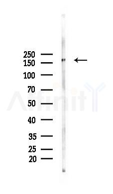 ABCA9 Antibody - Western blot analysis of lysates from Rat lung, using ABCA9 Antibody at 1/1000 dilution.
