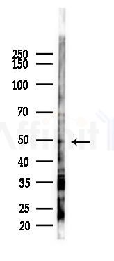 B3GALT2 Antibody - Western blot analysis of lysates from 293 cells(UV 30min treatment), using B3GALT2 Antibody at 1/1000 dilution.