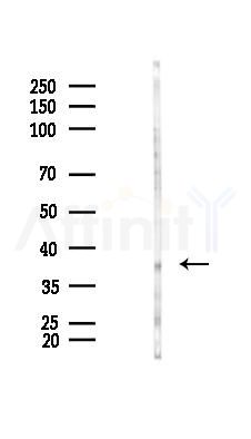 SLC25A14 Antibody - Western blot analysis of lysates from Hela cells(starvation 24h treatment), using SLC25A14 Antibody at 1/1000 dilution.