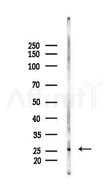 CAPNS2 Antibody - Western blot analysis of lysates from Rat lung, using CAPNS2 Antibody at 1/1000 dilution.