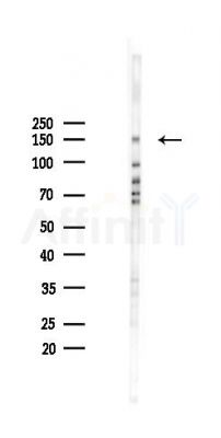 NCAPD3 Antibody - Western blot analysis of lysates from A2780 cells(starvation 24h treatment), using NCAPD3 Antibody at 1/1000 dilution.
