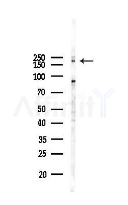 UBR2 Antibody - Western blot analysis of lysates from COLO205 cells(starvation 24h treatment), using UBR2 Antibody at 1/1000 dilution.