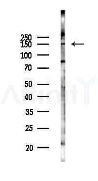 EDC4 Antibody - Western blot analysis of lysates from 293 cells(heat-shock 45min treatment), using EDC4 Antibody at 1/1000 dilution.
