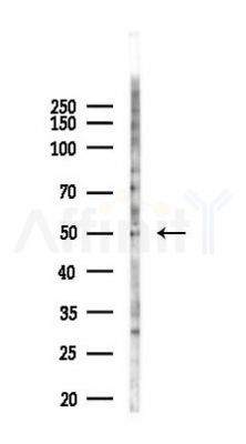 GABRR1 Antibody - Western blot analysis of lysates from Hela cells(heat-shock 45min treatment), using GABRR1 Antibody at 1/1000 dilution.