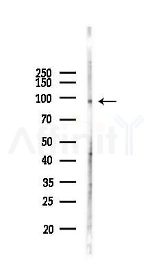 CSF3R Antibody - Western blot analysis of lysates from COLO205 cells(starvation 24h treatment), using CSF3R Antibody at 1/1000 dilution.