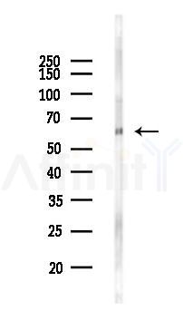 GNL3 Antibody - Western blot analysis of lysates from 293 cells(heat-shock 45min treatment), using GNL3 Antibody at 1/1000 dilution.