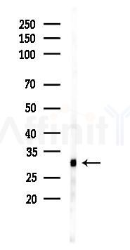 HLA-DMB Antibody - Western blot analysis of lysates from A2780 cells(starvation 24h treatment), using HLA-DMB Antibody at 1/1000 dilution.