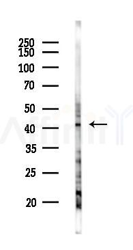 KHDRBS3 Antibody - Western blot analysis of lysates from HUVEC cells(UV 30min treatment), using KHDRBS3 Antibody at 1/1000 dilution.
