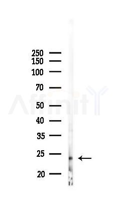 MED28 Antibody - Western blot analysis of lysates from K562 cells(starvation 24h treatment), using MED28 Antibody at 1/1000 dilution.