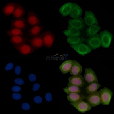 MED4 Antibody - DF9619 staining Hela cells(30min of UV treatment) by IF/ICC.