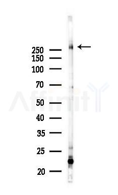 MAP1A Antibody - Western blot analysis of lysates from K562 cells(starvation 24h treatment), using MAP1A Antibody at 1/1000 dilution.