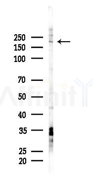 MYO5C Antibody - Western blot analysis of lysates from A2780 cells(starvation 24h treatment), using MYO5C Antibody at 1/1000 dilution.