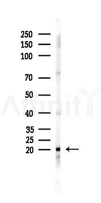NDUFS4 Antibody - Western blot analysis of lysates from A2780 cells(starvation 24h treatment), using NDUFS4 Antibody at 1/1000 dilution.