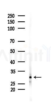 CYB5R2 Antibody - Western blot analysis of lysates from A2780 cells(starvation 24h treatment), using CYB5R2 Antibody at 1/1000 dilution.