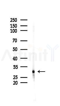 CYB5R2 Antibody - Western blot analysis of lysates from Hela cells(starvation 24h treatment), using CYB5R2 Antibody at 1/1000 dilution.