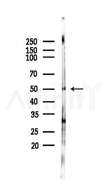 SC65 Antibody - Western blot analysis of lysates from PC12 cells(heat-shock 45min treatment), using SC65 Antibody at 1/1000 dilution.