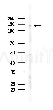 PALLD Antibody - Western blot analysis of lysates from A2780 cells(starvation 24h treatment), using PALLD Antibody at 1/1000 dilution.
