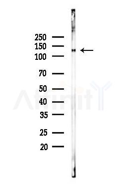 ATP2B1/2/3 Antibody - Western blot analysis of lysates from PC12 cells(heat-shock 45min treatment), using ATP2B1/2/3 Antibody at 1/1000 dilution.