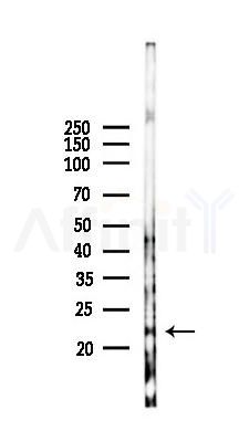 CD164 Antibody - Western blot analysis of lysates from 293 cells(heat-shock 45min treatment), using CD164 Antibody at 1/1000 dilution.