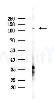 SFRS14 Antibody - Western blot analysis of lysates from PC12 cells(starvation 24h treatment), using SFRS14 Antibody at 1/1000 dilution.