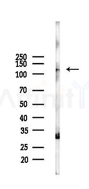 SFRS14 Antibody - Western blot analysis of lysates from Rat lung, using SFRS14 Antibody at 1/1000 dilution.
