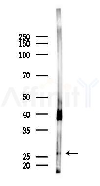 TIGA1 Antibody - Western blot analysis of lysates from Rat muscle, using TIGA1 Antibody at 1/1000 dilution.