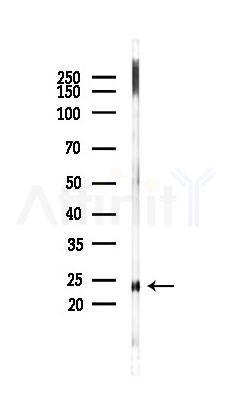 RAB21 Antibody - Western blot analysis of lysates from Rat liver, using RAB21 Antibody at 1/1000 dilution.
