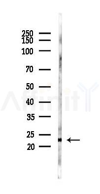 RAB24 Antibody - Western blot analysis of lysates from Rat liver, using RAB24 Antibody at 1/1000 dilution.