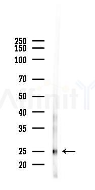 RND2 Antibody - Western blot analysis of lysates from Mouse lung, using RND2 Antibody at 1/1000 dilution.