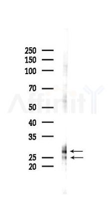 RND2 Antibody - Western blot analysis of lysates from RAW264.
